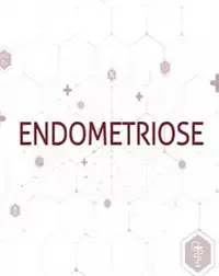 Endometriose: Diagnóstico correto por ressonância magnética garante tratamento eficaz