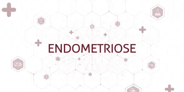 Endometriose: Diagnóstico correto por ressonância magnética garante tratamento eficaz